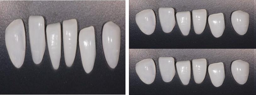 冰瓷美牙 冰瓷美牙