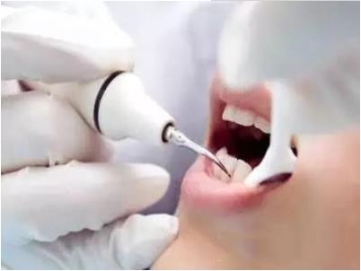 纳米齿雕 纳米齿雕