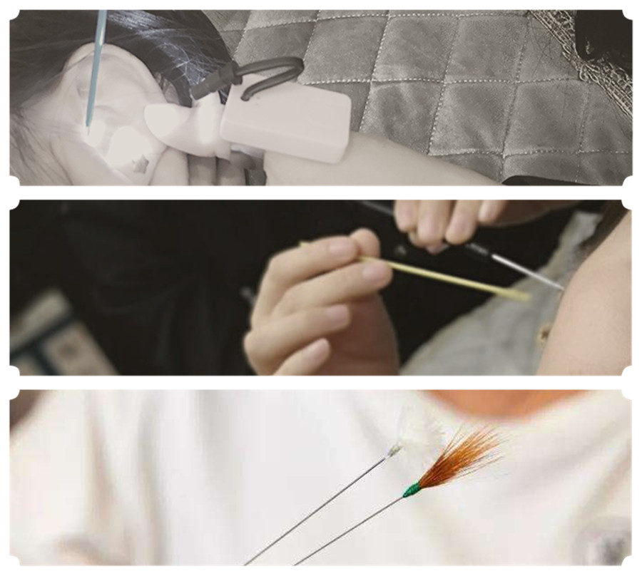 采耳培训方法：取耳结石