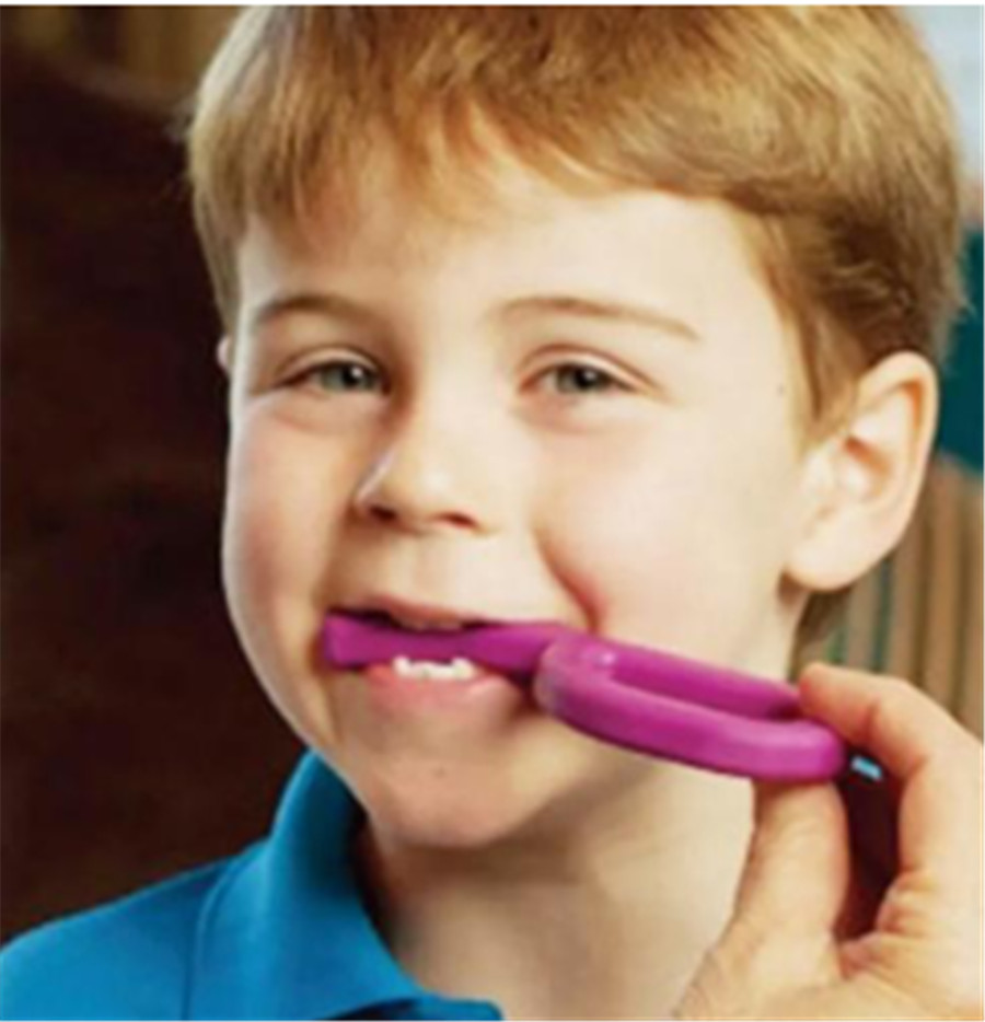 三岁孩子有语言障碍怎么办？