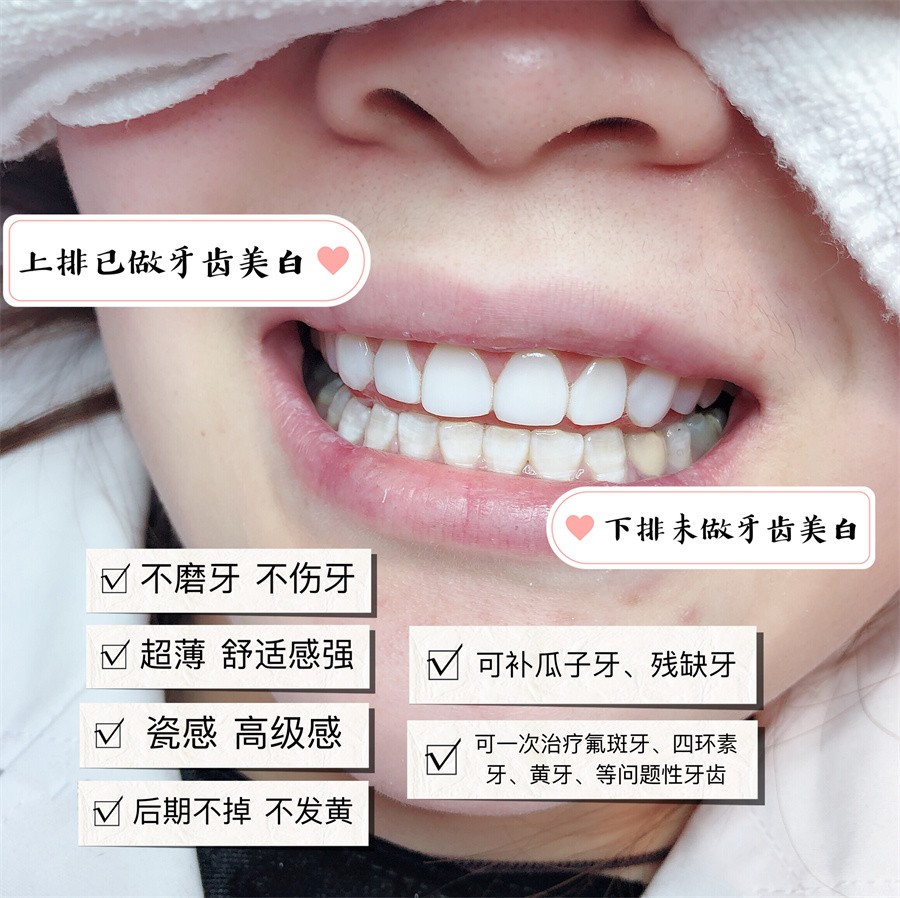 天津十大牙齿美白培训学校排名 天津十大牙齿美白培训学校排名