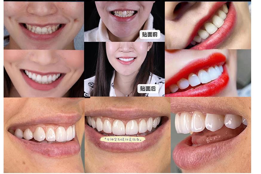 上海十大全瓷贴面美牙培训机构排名 上海十大全瓷贴面美牙培训机构排名