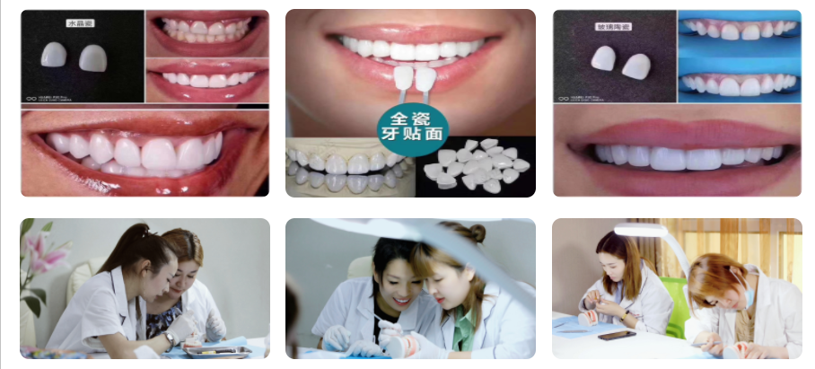 上海美牙培训-美牙技术培训-美牙培训机构-美邦铭心美牙培训中心 上海美牙培训-美牙技术培训-美牙培训机构-美邦铭心美牙培训中心