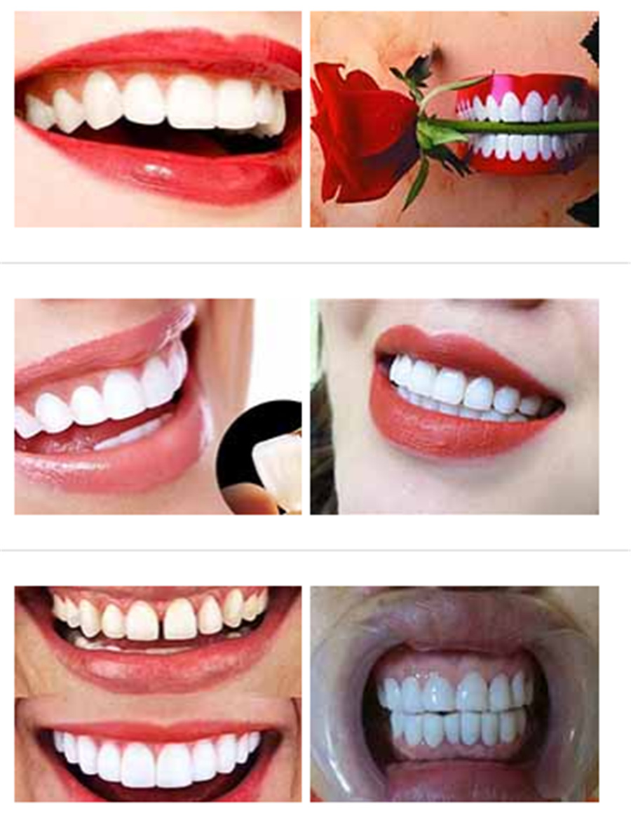 三大内蒙古美牙培训学校实力排名-美牙培训费用