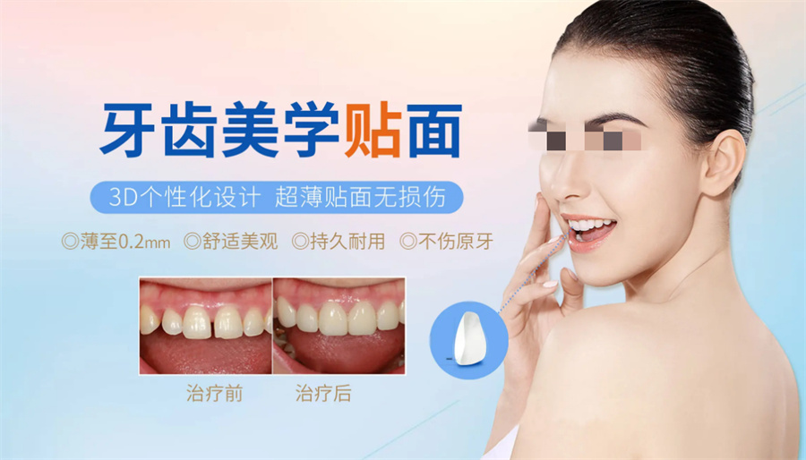 三大牙齿贴面美牙培训机构实力排名推荐-美邦铭心 三大牙齿贴面美牙培训机构实力排名推荐-美邦铭心