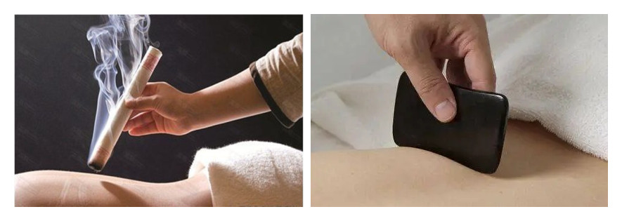 三大专业中医艾灸培训学校排名一览