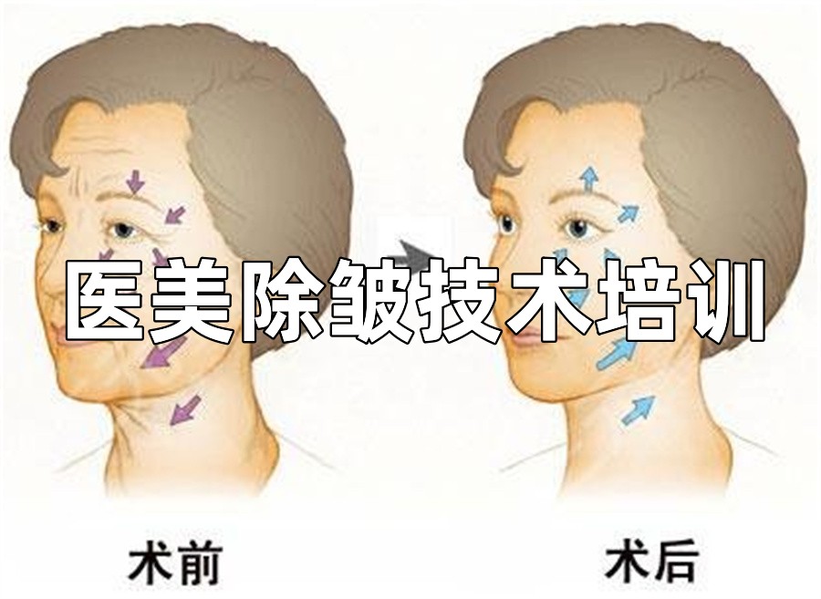 广东省内轻医美除皱技术培训机构十大排名-正规微整培训