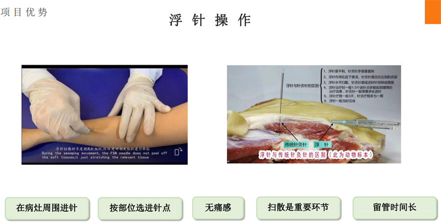 中医浮针专业正规培训机构真情推荐-中医浮针培训课程