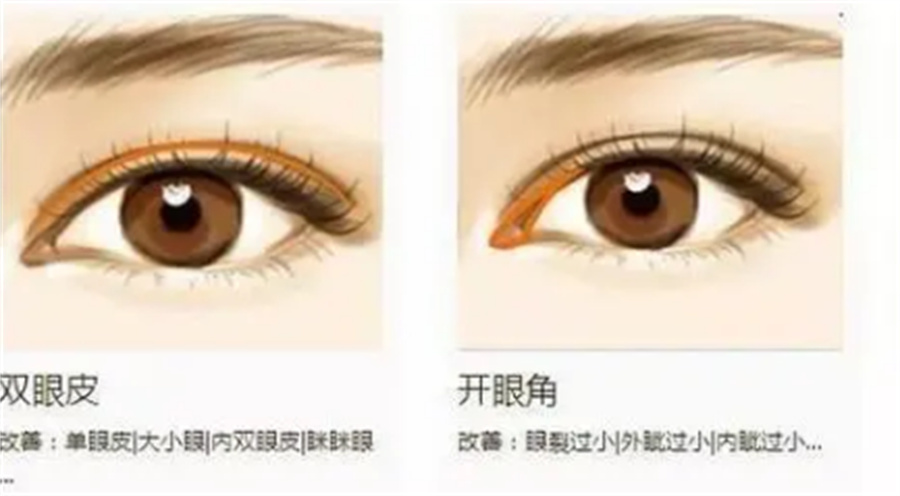 公布十大正规排名好的双眼皮微整形课程培训机构名单