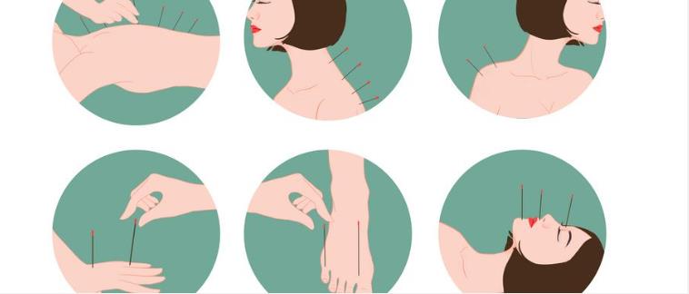 十大中医针灸培训机构热门推荐汇集 十大中医针灸培训机构热门推荐汇集