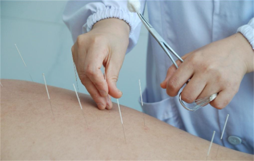 中医针灸培训机构 中医针灸培训机构