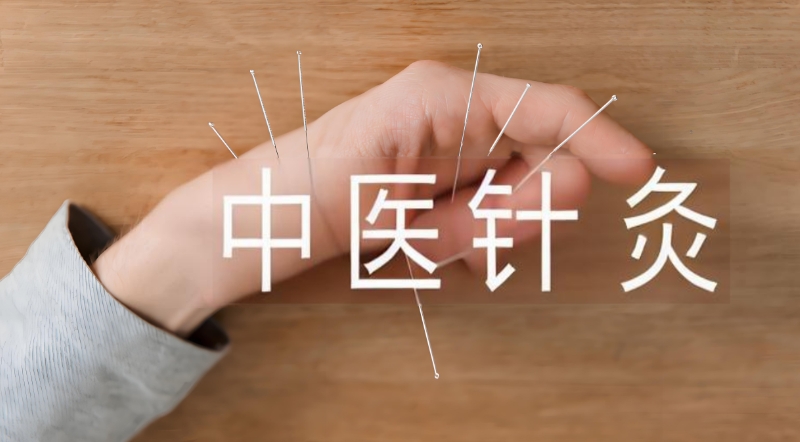 中医针灸培训 中医针灸培训