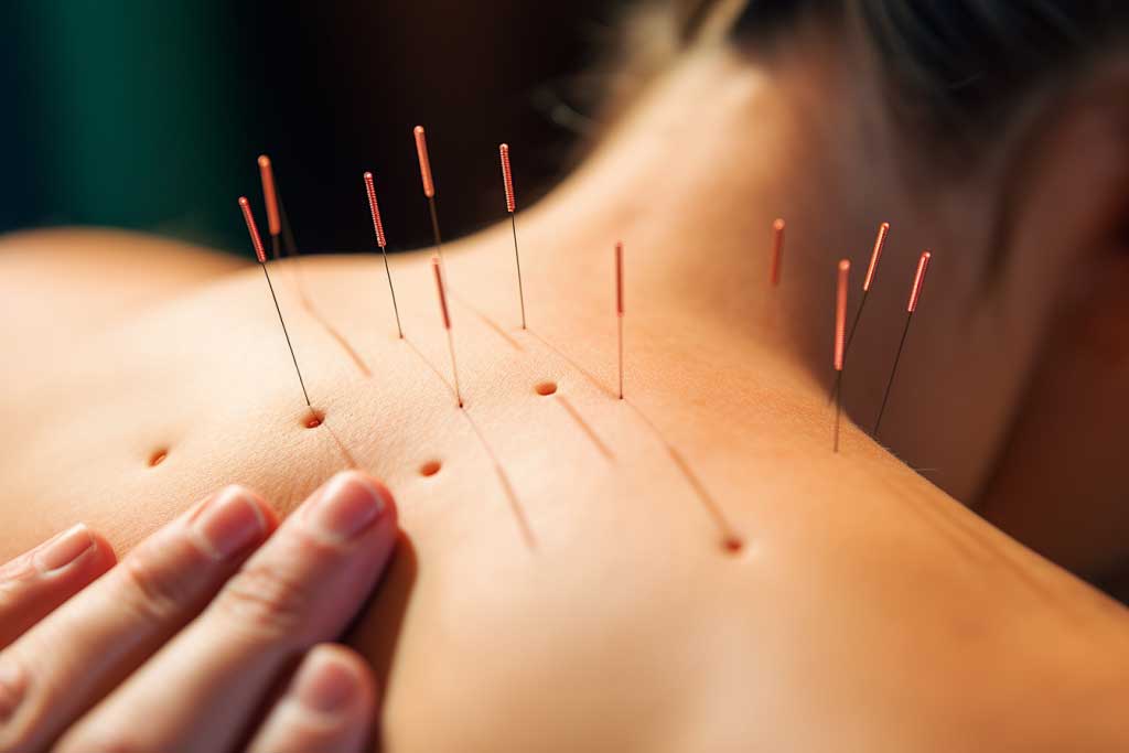 推荐中医针灸类师承培训机构十大排名Top发布