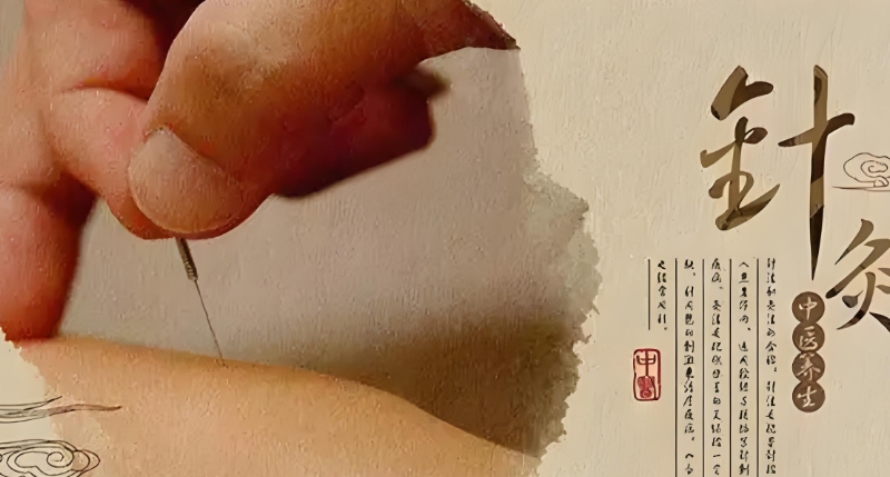 针灸培训