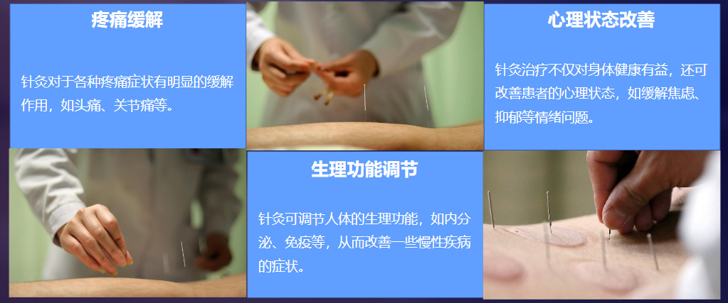 中医针灸培训机构 中医针灸培训机构