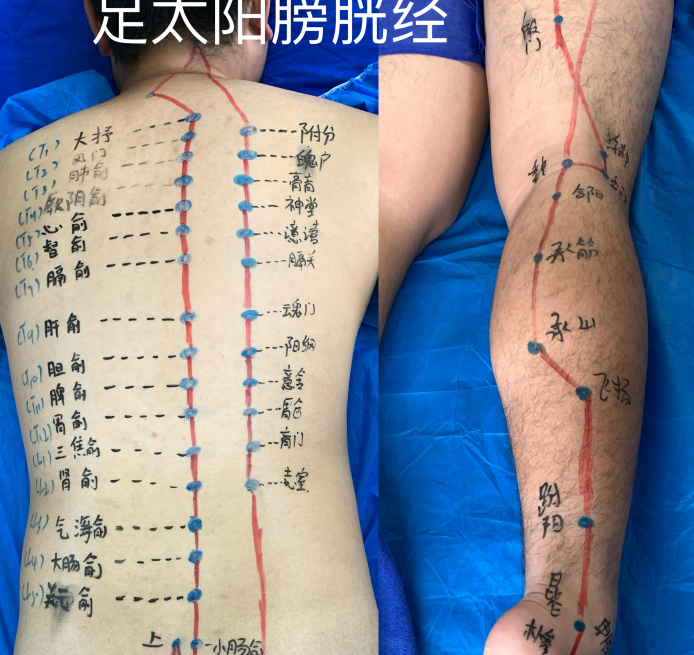 中医针灸、诊脉、穴位培训 中医针灸、诊脉、穴位培训