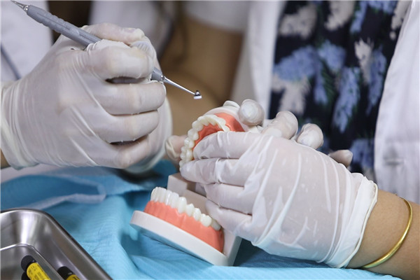 全瓷贴面技术班