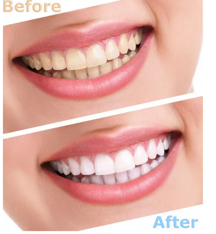 美邦铭心美牙 美邦铭心美牙