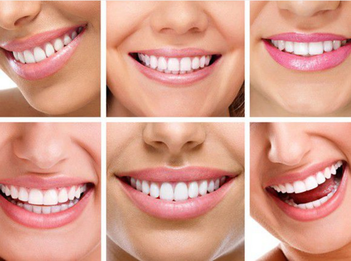 美邦铭心美牙 美邦铭心美牙