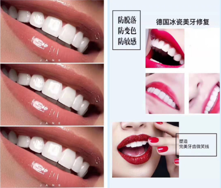 美邦铭心美牙 美邦铭心美牙