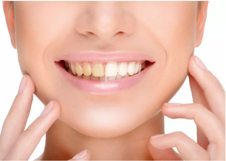 美邦铭心美牙 美邦铭心美牙