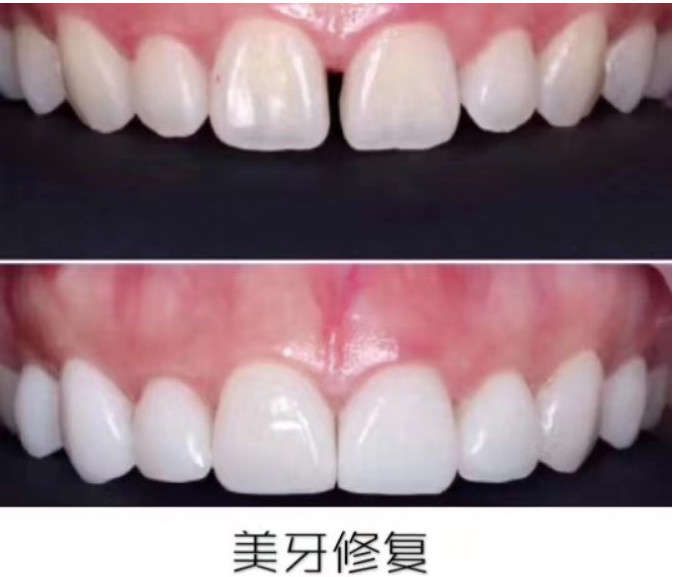 美邦铭心美牙 美邦铭心美牙