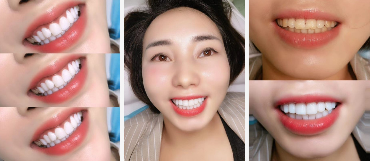 美邦铭心美牙 美邦铭心美牙