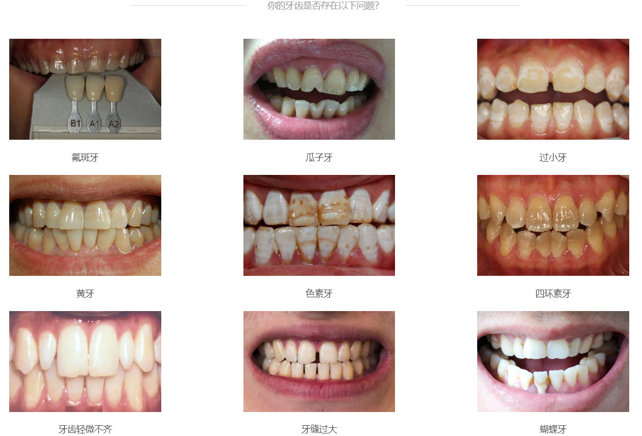 美邦铭心美牙 美邦铭心美牙