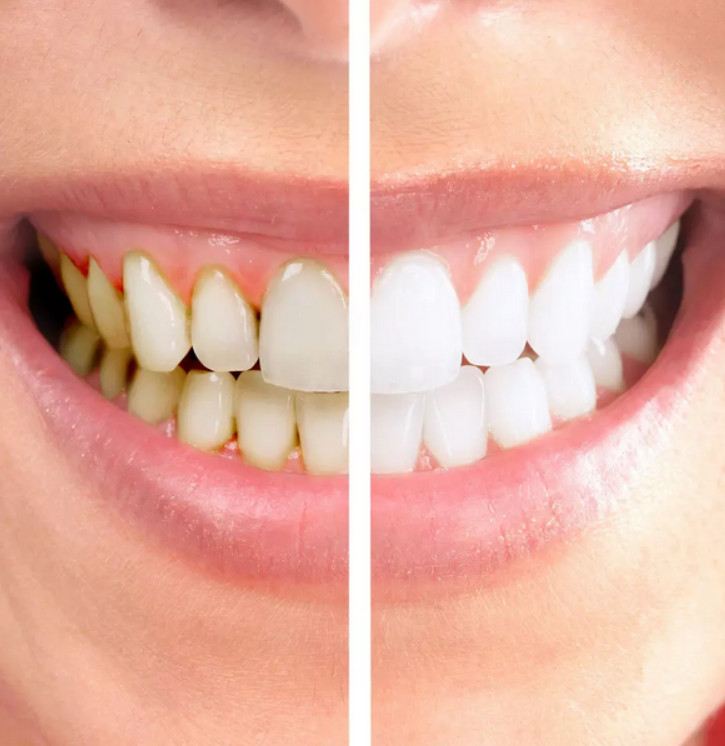 美邦铭心美牙 美邦铭心美牙