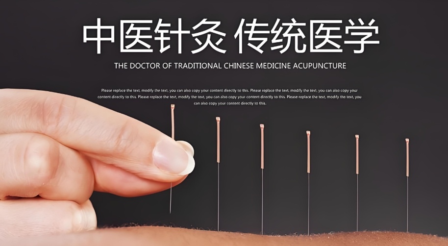 针灸培训班如何选择 针灸培训班排名