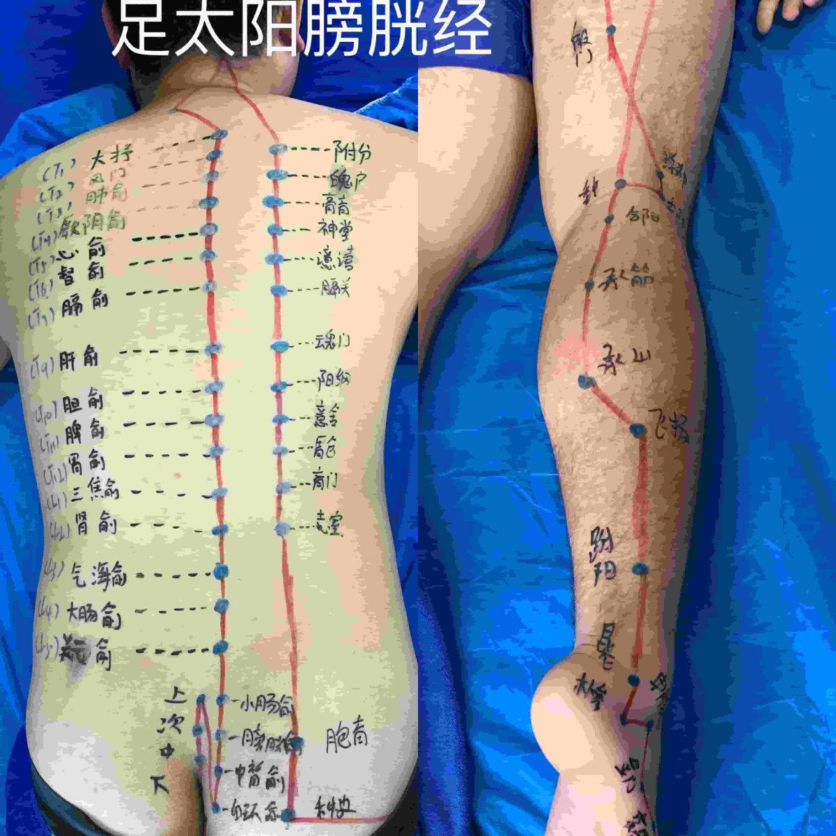 广东中医基础技能培训