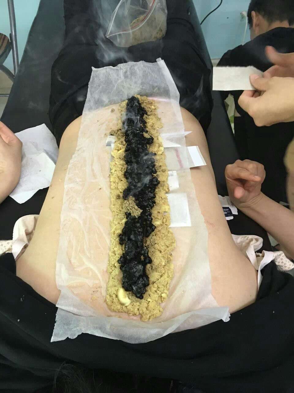 广东教学质量上乘广州中医针灸精华培训班