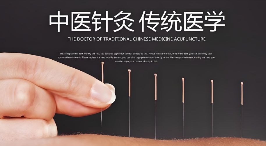 房山区中医针灸培训